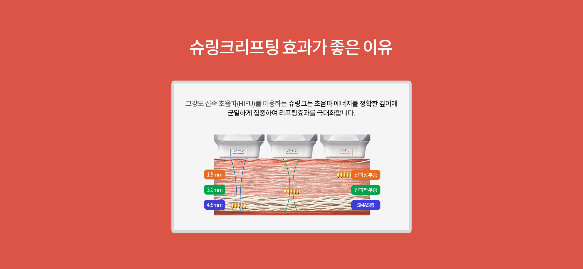 슈링크리프팅 좋은이유