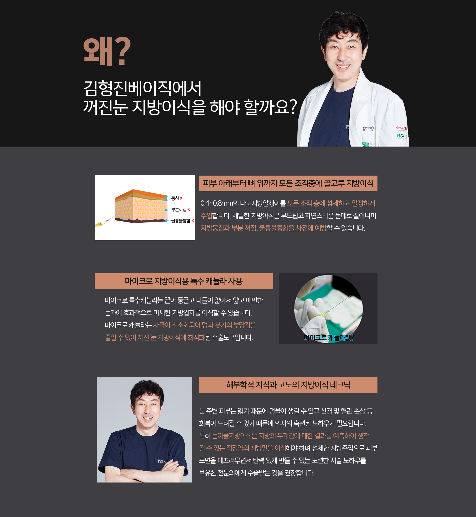 김형진베이직성형외과 꺼진 눈(꺼풀) 지방이식 특별한 이유