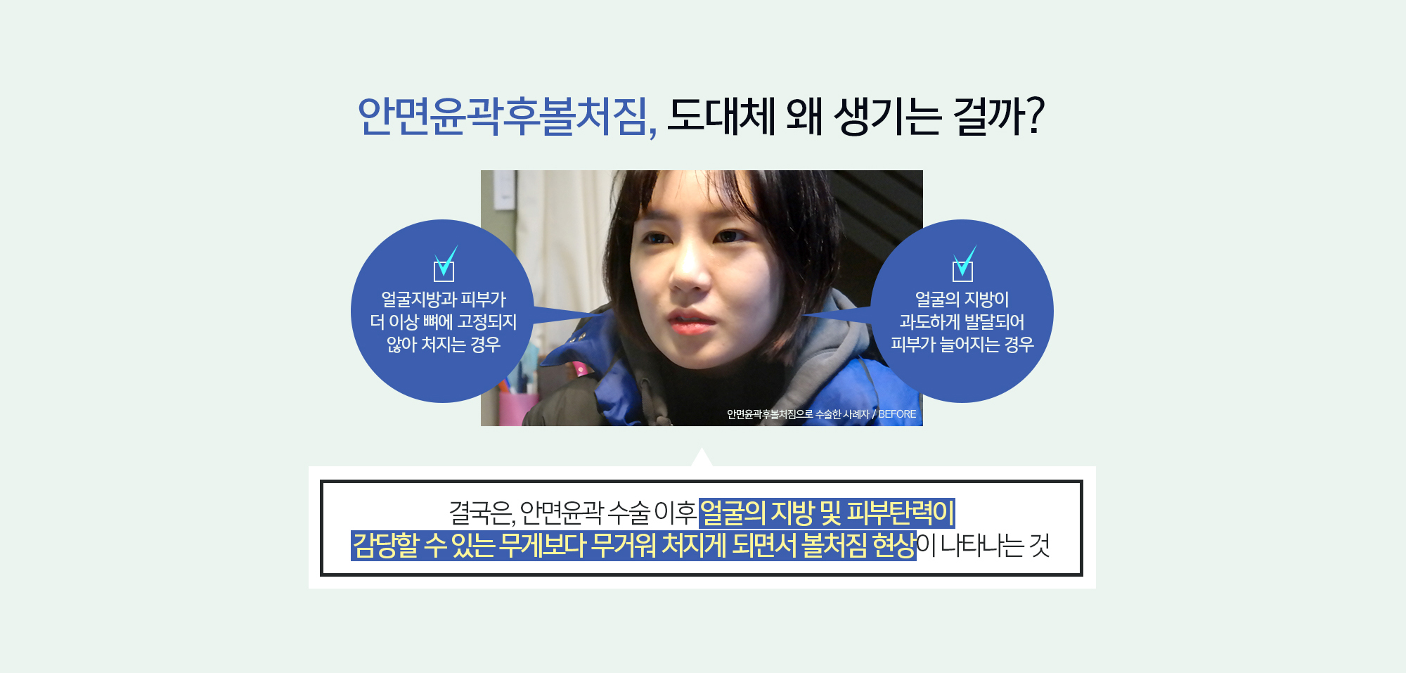 안면윤곽후볼처짐, 도대체 왜 생기는걸까