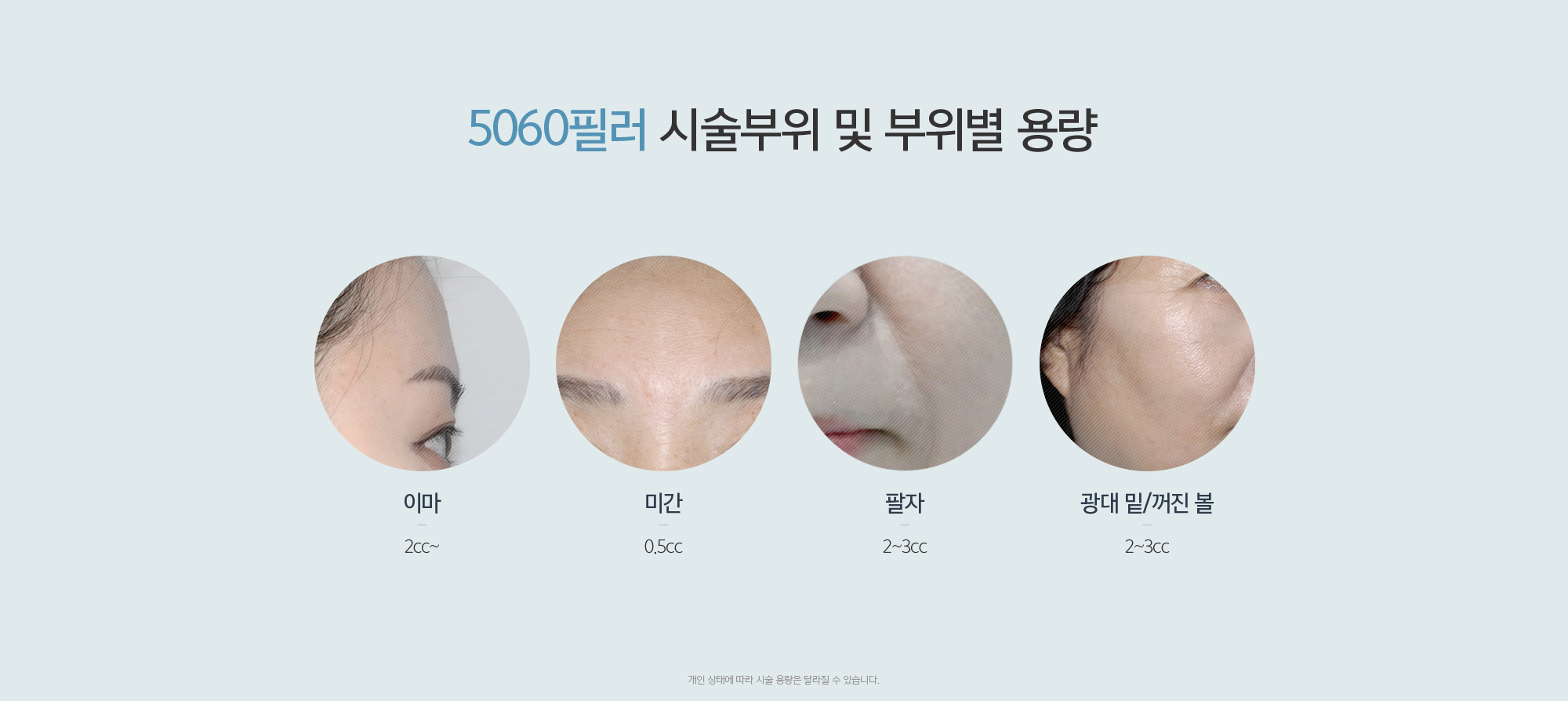 5060필러 시술부위 및 부위별 용량