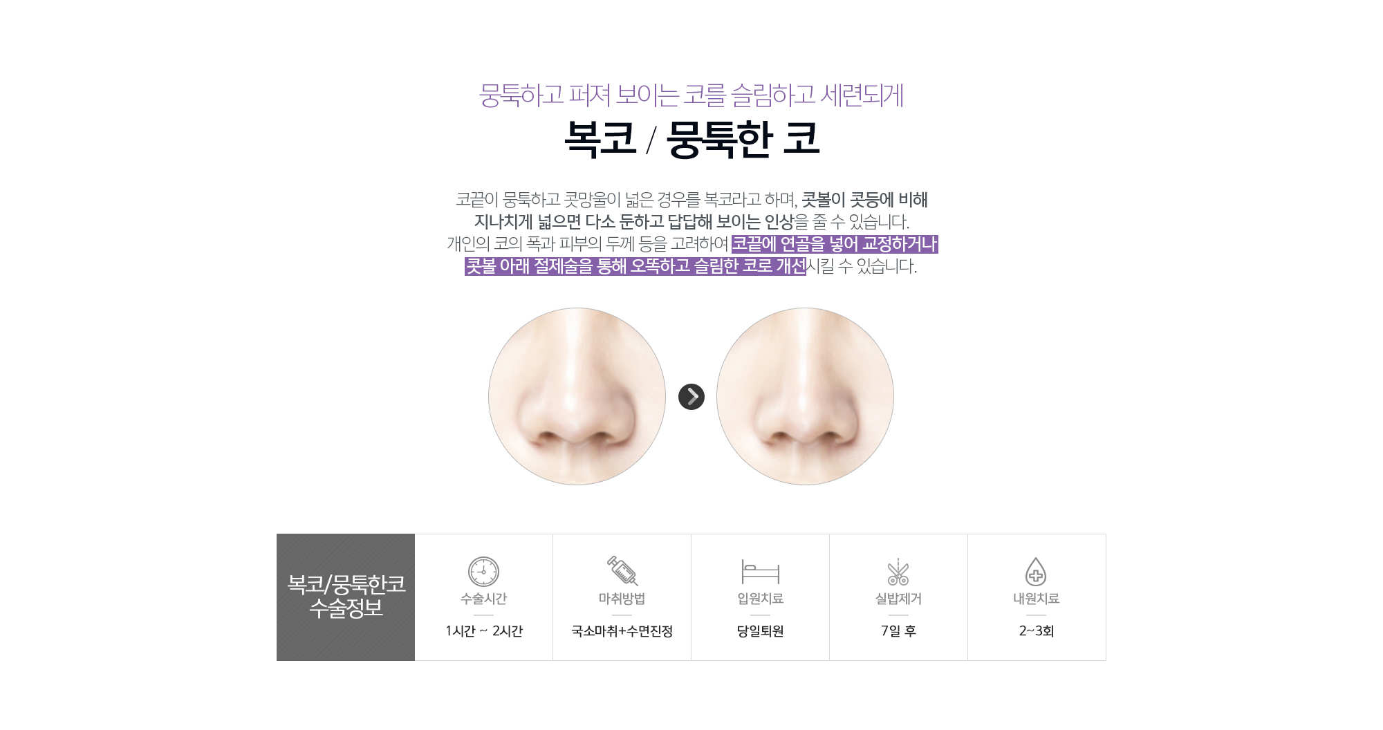 복코/뭉툭한코성형