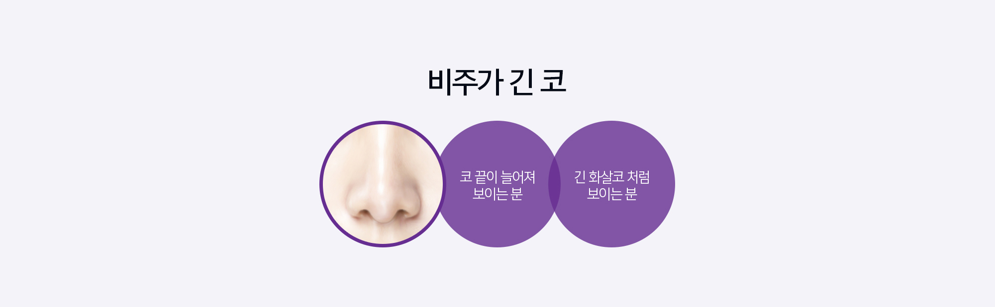 비주가 긴 코